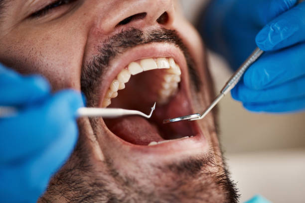 Best Emergency Treatment for Oral Infections in Fort Pierce South, FL