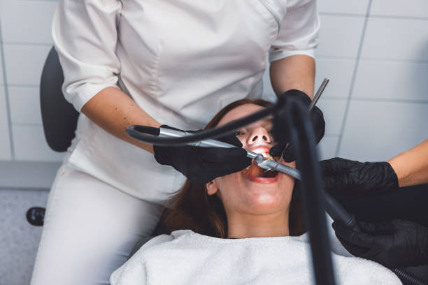 Best Knocked-Out Tooth (Avulsed Tooth) Treatment in Fort Pierce South, FL